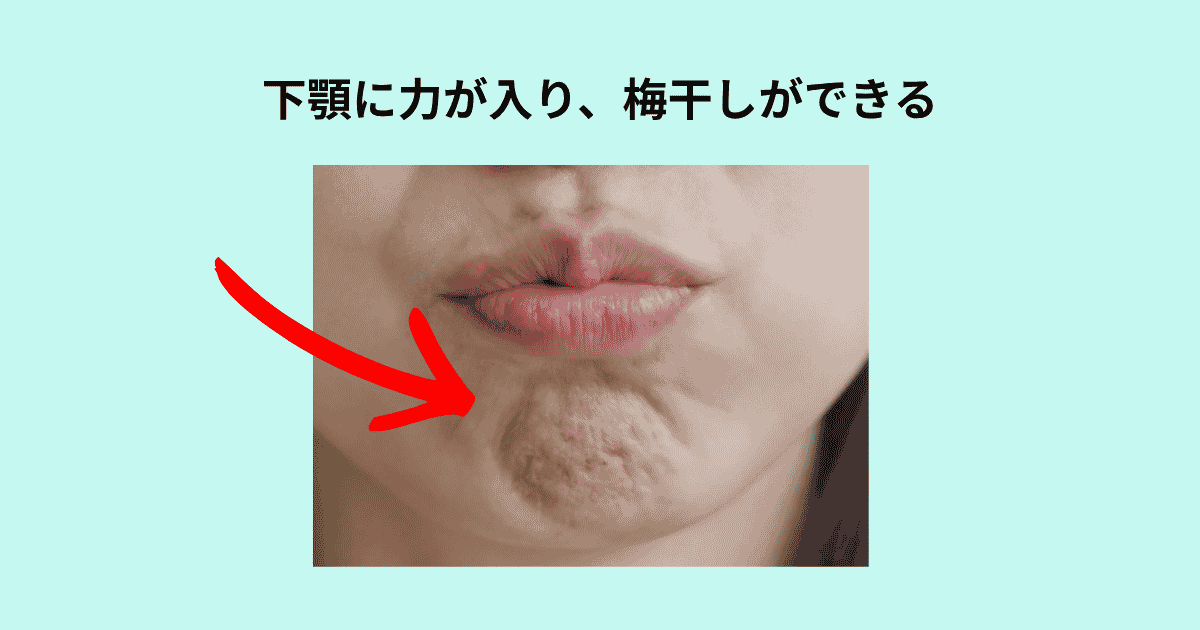 下あごに力が入り梅干しができる様子